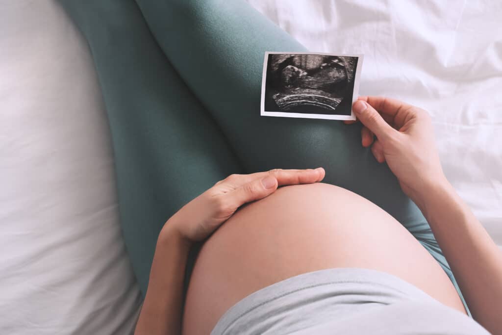 Graviditetsscanning, gravid scanning privat, gravid scanning københavn