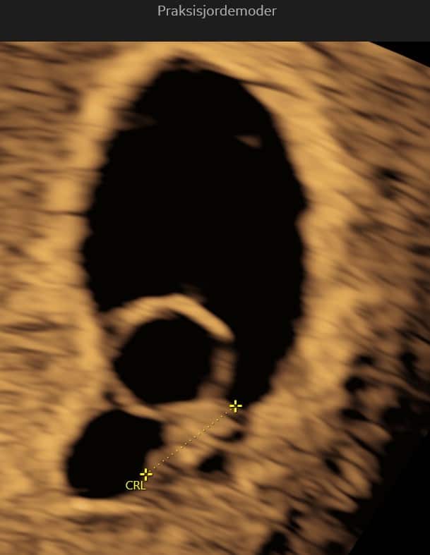 Tryghedsscanning uge 6