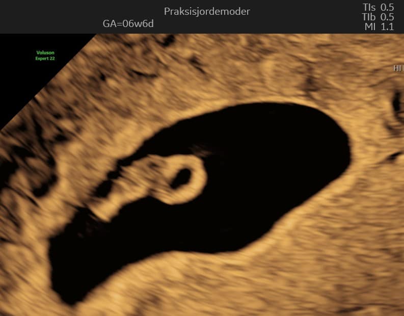 Tryghedsscanning uge 6