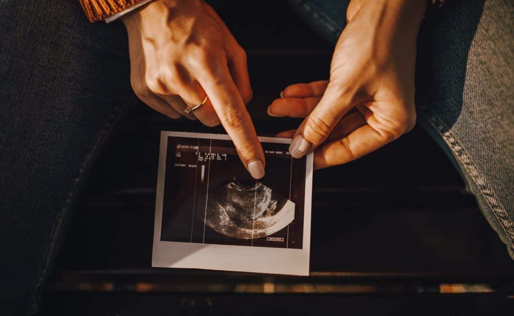 tidlig scanning uge 7